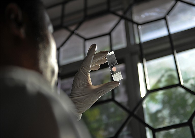 A lab technician holds a blood sample up to the light from a window in Tanzania