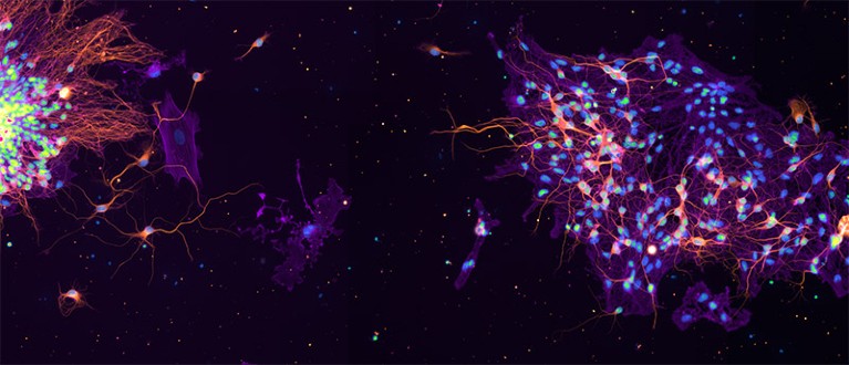 Primary cultures of rodent hippocampal neurons are stained for microtubules and actin