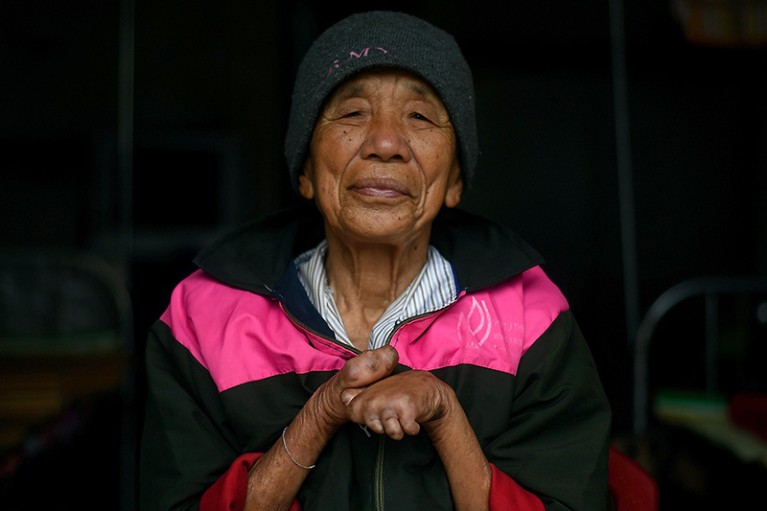 A woman with her hands disabled as a result of leprosy smiles at the camera, against a black background.