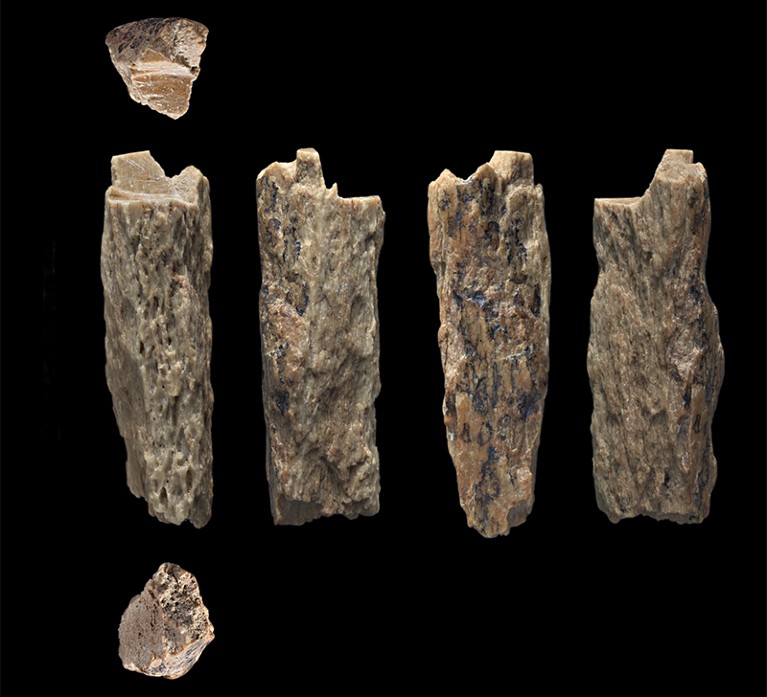 A row of bone fragments.
