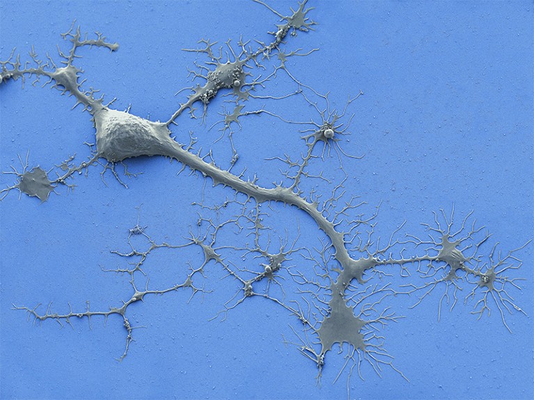 Micrograph of human nerve cell