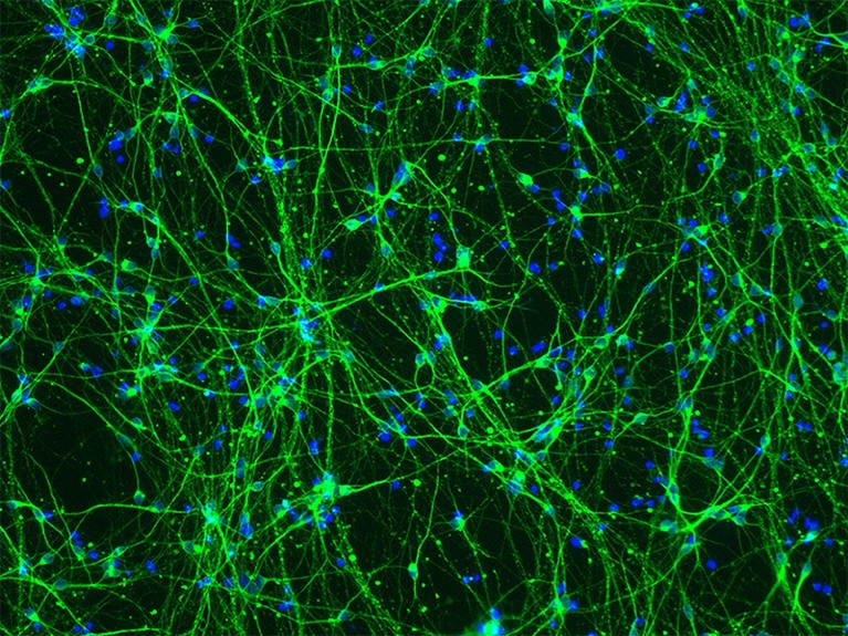 Light micrograph showing neurons derived from stem cells