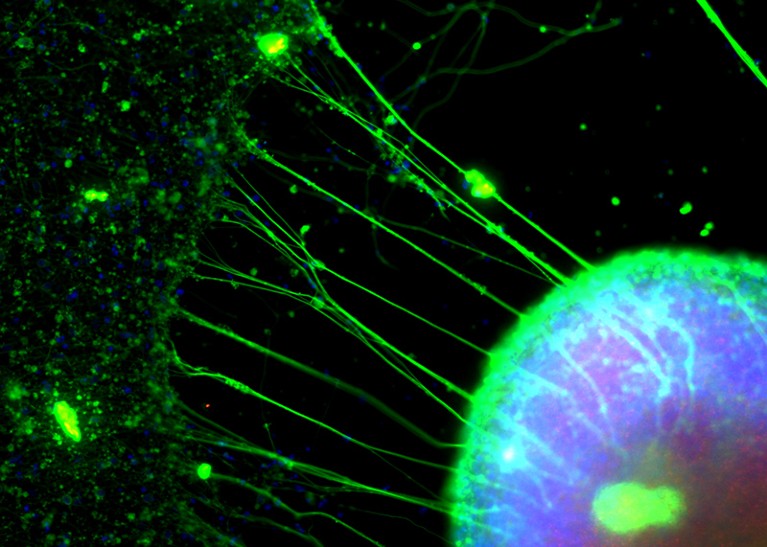 Neurons in culture, with the nuclei stained blue and the proteins stained green.