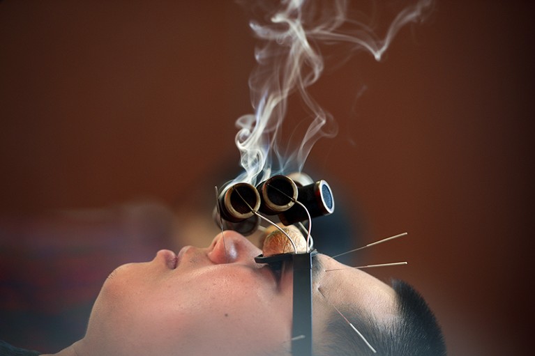 A man wearing 'walnut' glasses is treated with smoking wormwood to relieve his oculomotor paralysis.
