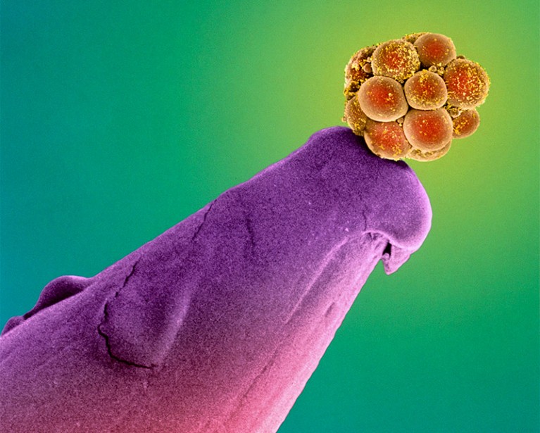 Coloured scanning electron micrograph (SEM) of a human embryo at the 16-cell stage on the tip of a pin.
