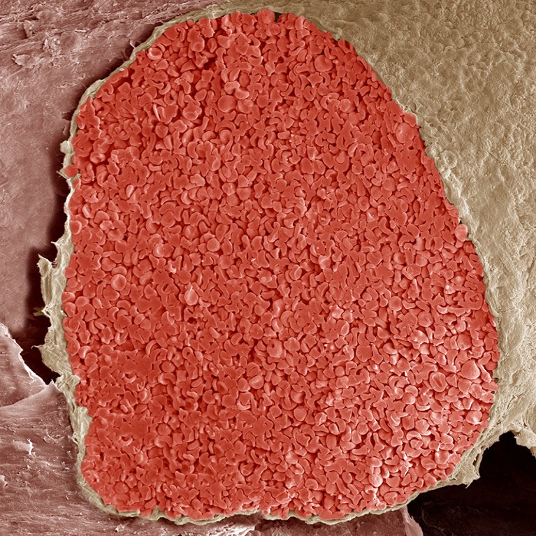 Coloured scanning electron micrograph of a foetal vein