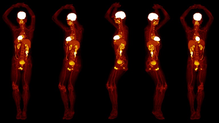 Views from an FDG-PET scan performed on a healthy subject using the EXPLORER Total Body PET scanner