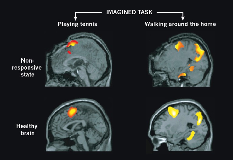 Brain scans are putting a major theory of consciousness to the test