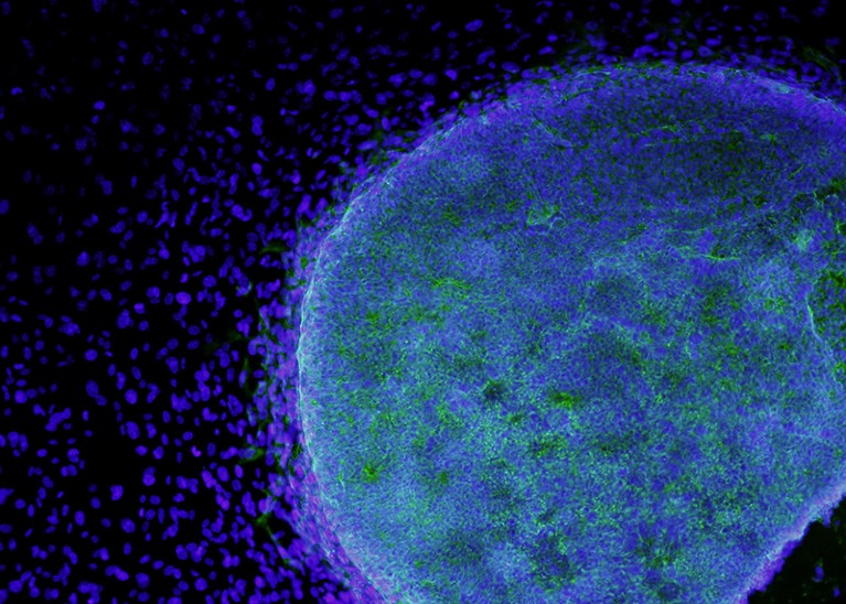 A colony of human embryonic stem cells (light blue) growing on fibroblasts (dark blue)