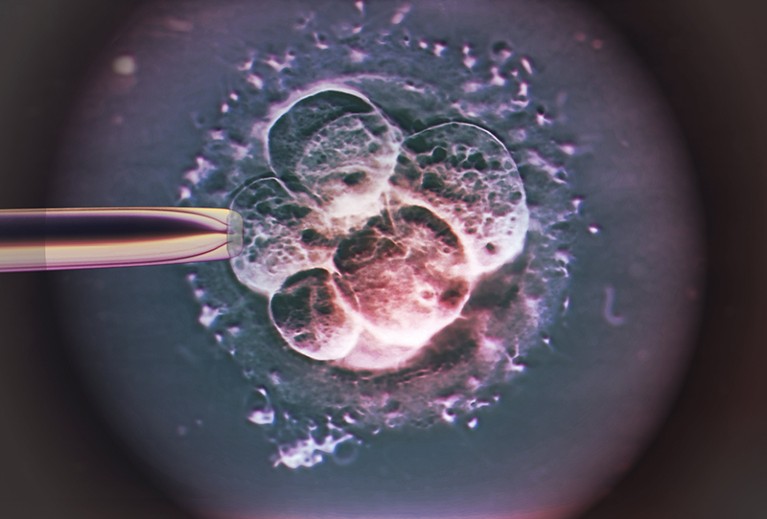Coloured light micrograph of a human embryo 48-72 hours after in vitro fertilisation