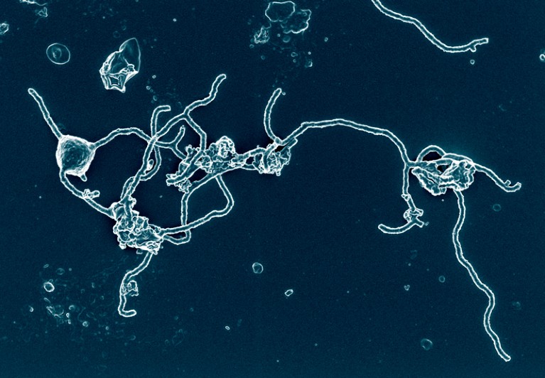 Electron microscopy image of Prometheoarchaeum syntrophicum, the closest cultured prokaryotic relative of eukaryotes.
