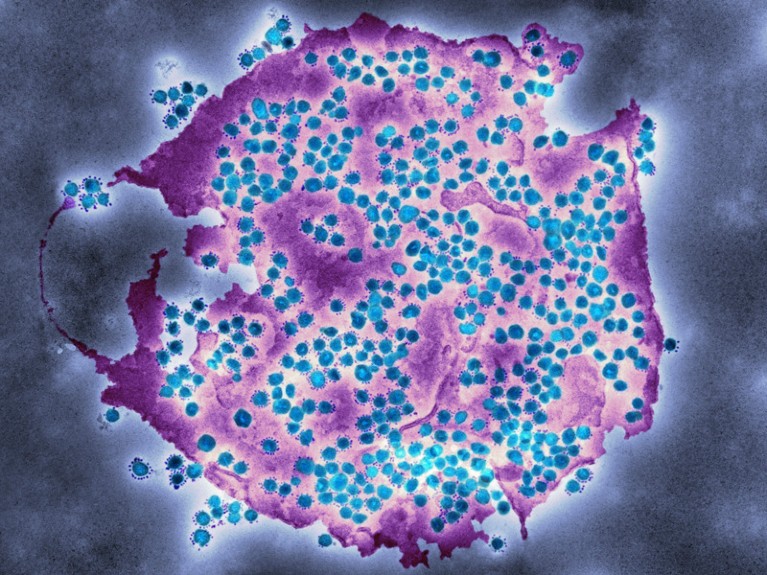 Coloured transmission electron micrograph: a purple smear covered in small blue blobs.