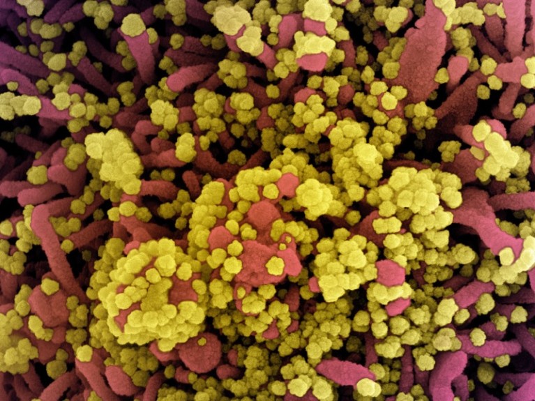 Colorized scanning electron micrograph of a cell heavily infected with SARS-CoV-2 virus particles (yellow).