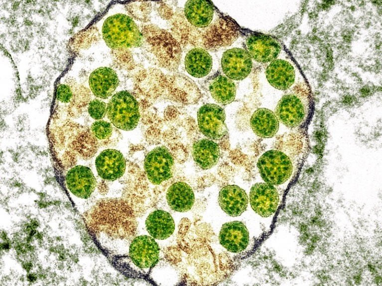 Cell infected with Covid-19 coronavirus particles, TEM.
