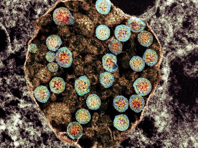 Coloured transmission electron micrograph (TEM) of a cell infected with SARS-CoV-2 coronavirus particles (blue and orange).