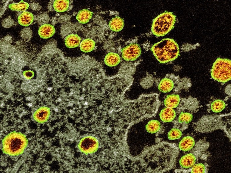 TEM of SARS-CoV-2 coronavirus particles (yellow) isolated from the first US case of the disease Covid-19.