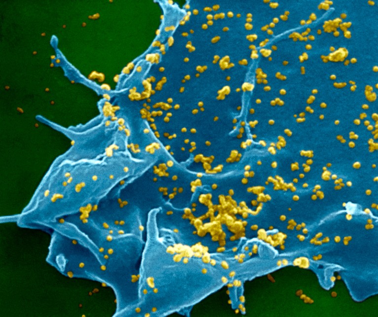 SEM of coronavirus particles on the surface of a culture cell