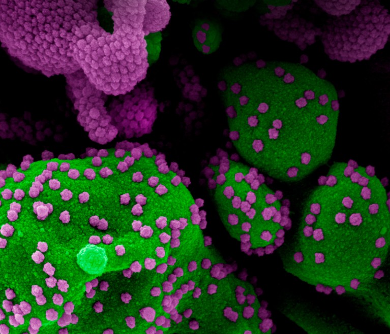 Coloured scanning electron micrograph of SARS-CoV-2 coronavirus particles
