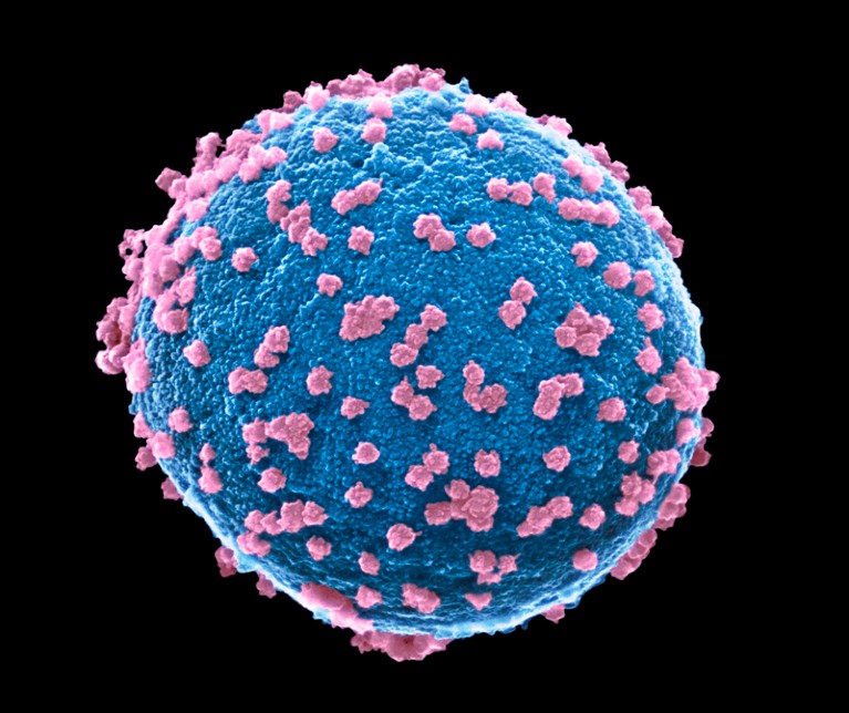 Coloured scanning electron micrograph showing a bleb from a cultured cell infected with SARS-CoV-2 virus particles