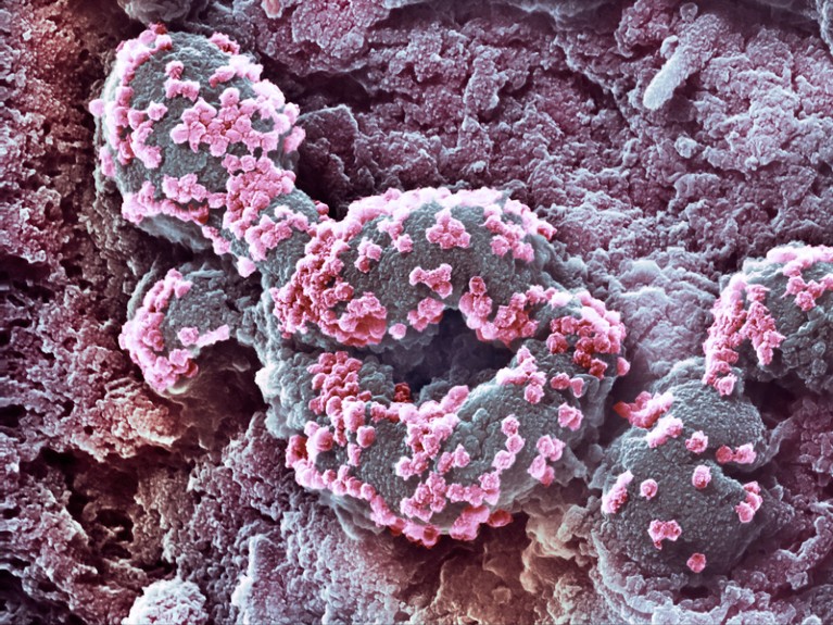 Coloured scanning electron micrograph showing a cultured cell infected with SARS-CoV-2 virus particles