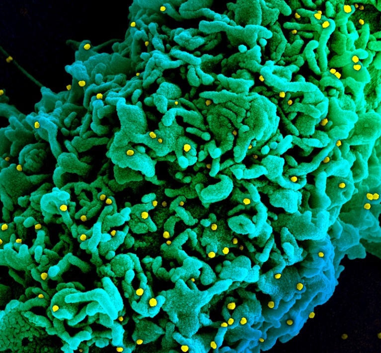 Coloured scanning electron micrograph of a cell infected with B.1.1.7 variant Covid-19 coronavirus particles