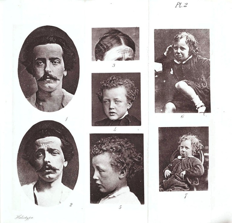 'Expressions of Grief' photos from 'The Expression of the Emotions in Man and Animals' by Charles Darwin
