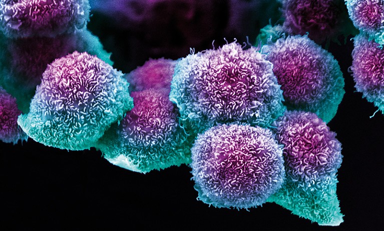 Scanning electron microscope image of early stage pancreatic cancer cells
