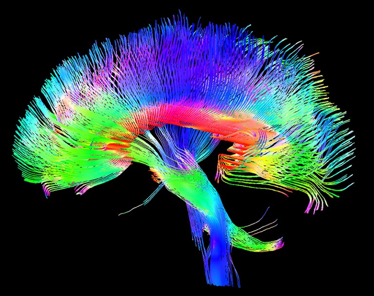 Side view of a coloured 3D scan of the white matter pathways of the human brain.