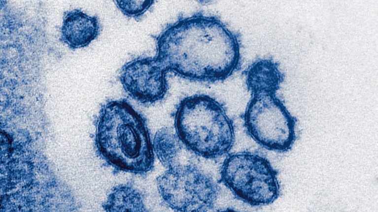 Covid-19 coronavirus, TEM.