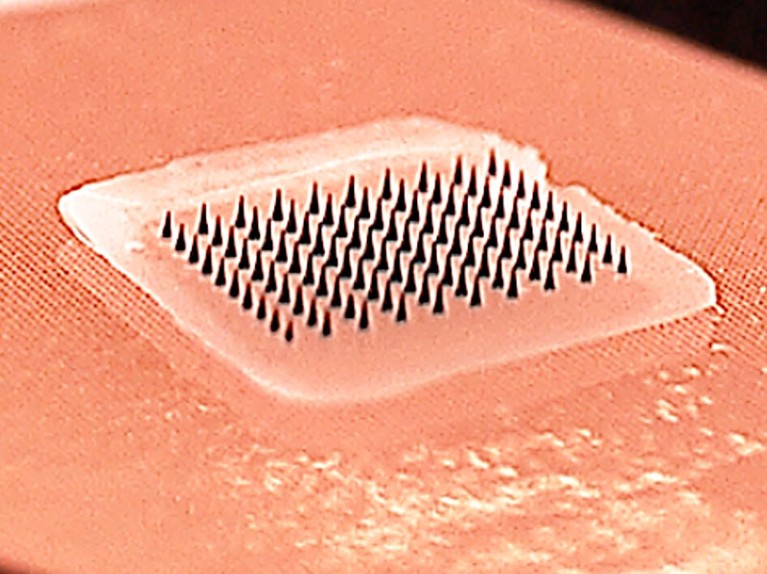 A close-up of multiple small needles in a grid pattern.
