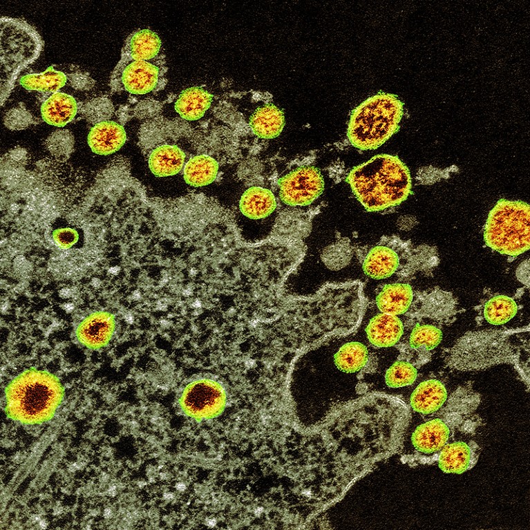 Coloured transmission electron micrograph (TEM) of SARS-CoV-2 coronavirus particles