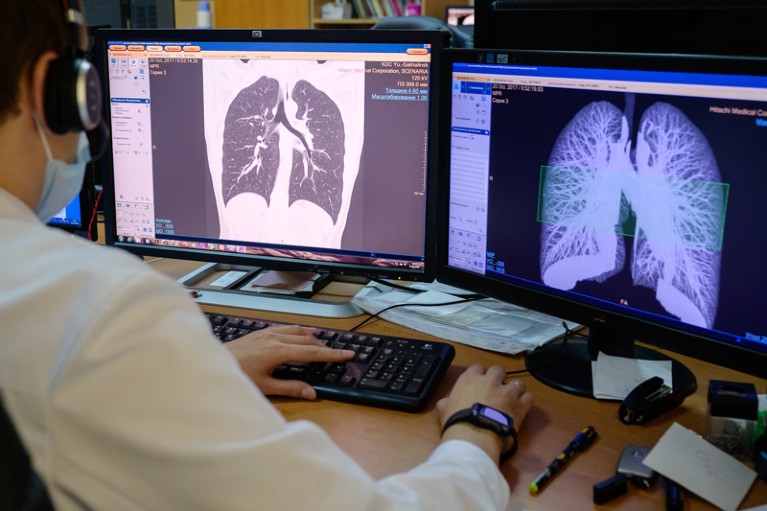 A medical worker looks at monitors showing lung CT scans