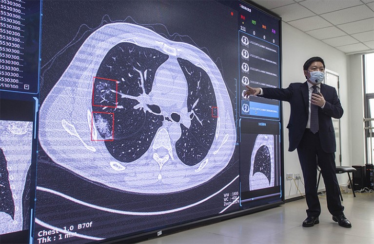 A doctor weraing a face mask stands in front of a huge screen displaying a body scan