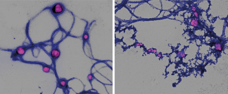 Two images showing collagen breaking down