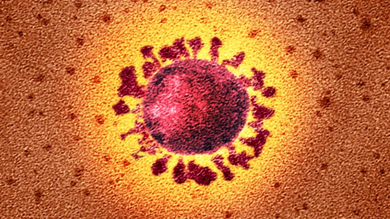 Coloured transmission electron micrograph of a SARS-CoV-2 coronavirus particle