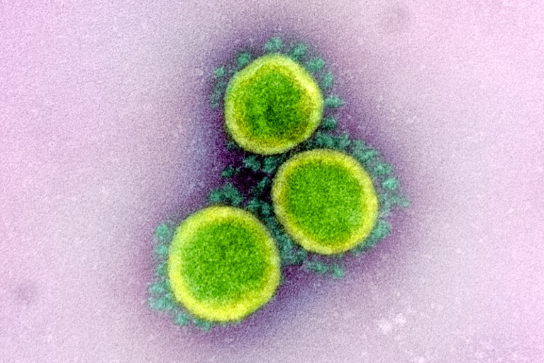Coloured transmission electron micrograph of SARS-CoV-2 coronavirus particles
