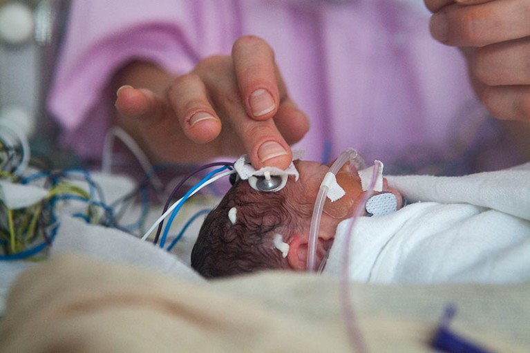 premature babies 24 weeks survival rate