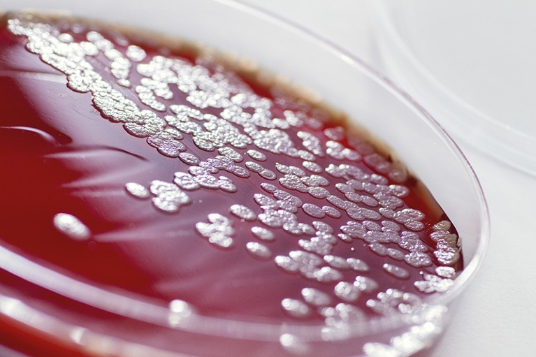 A Petri dish with bacteria growing on it