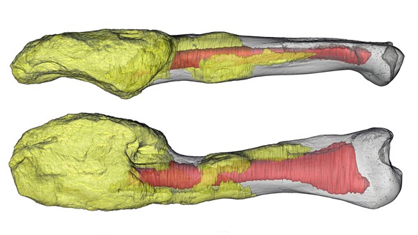 Two views of a dinosaur bone, with bone cancer shown in yellow