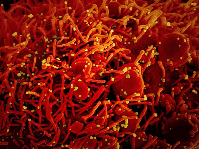 SEM of SARS-CoV-2 coronavirus particles (yellow) on an apoptotic cell (red) from a US patient sample.
