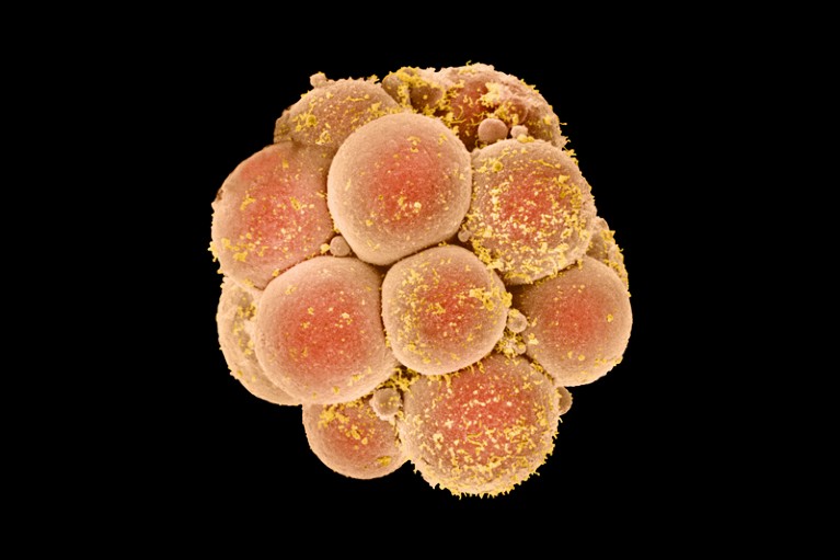 Coloured scanning electron micrograph of a human embryo at the sixteen cell stage