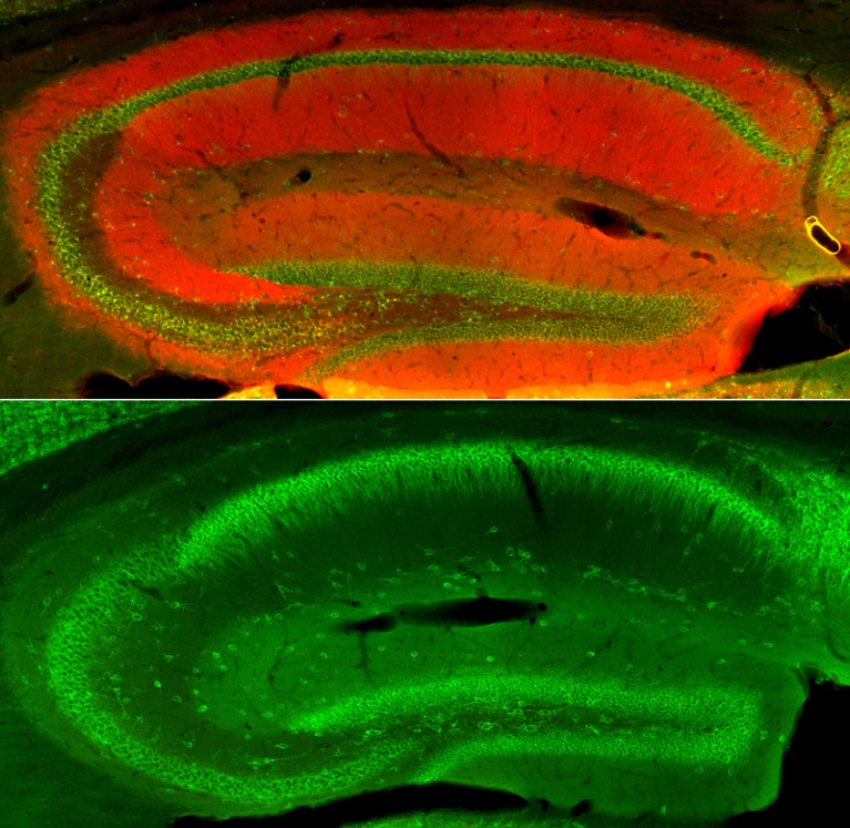 Two immunofluorescence images of rat brain