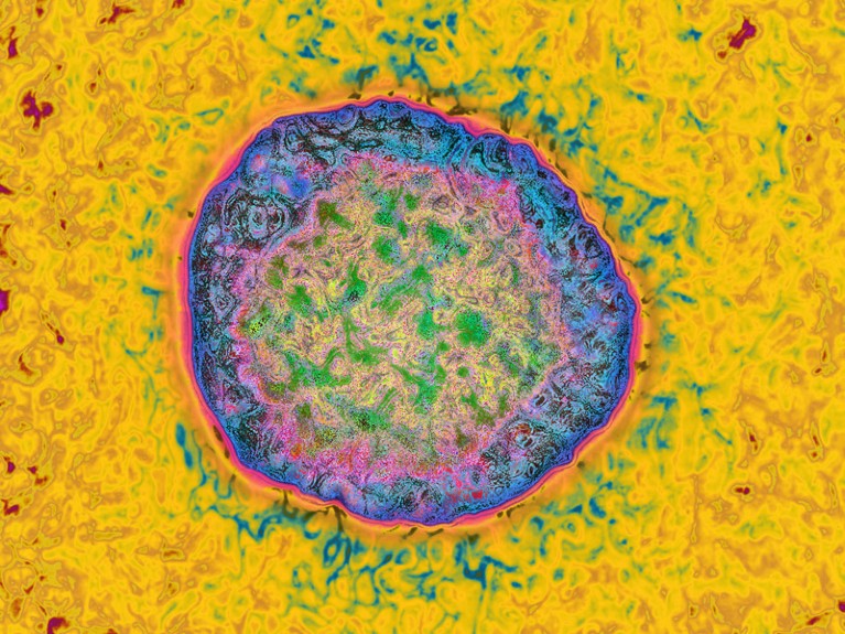 Hepatitis C virus (HCV). HDRI images from an image taken with transmission electron microscopy.