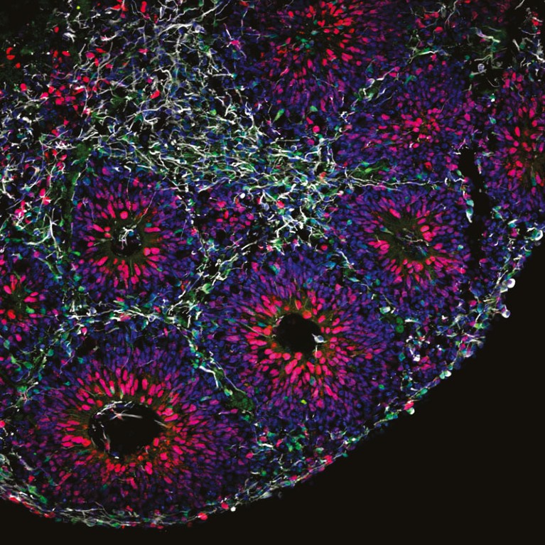 Micrograph of a developing brain organoid with different types of cells labelled in different colours