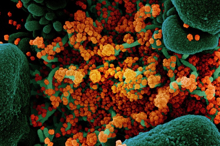 Colorized scanning electron micrograph of an apoptotic cell heavily infected with SARS-CoV-2 virus particles