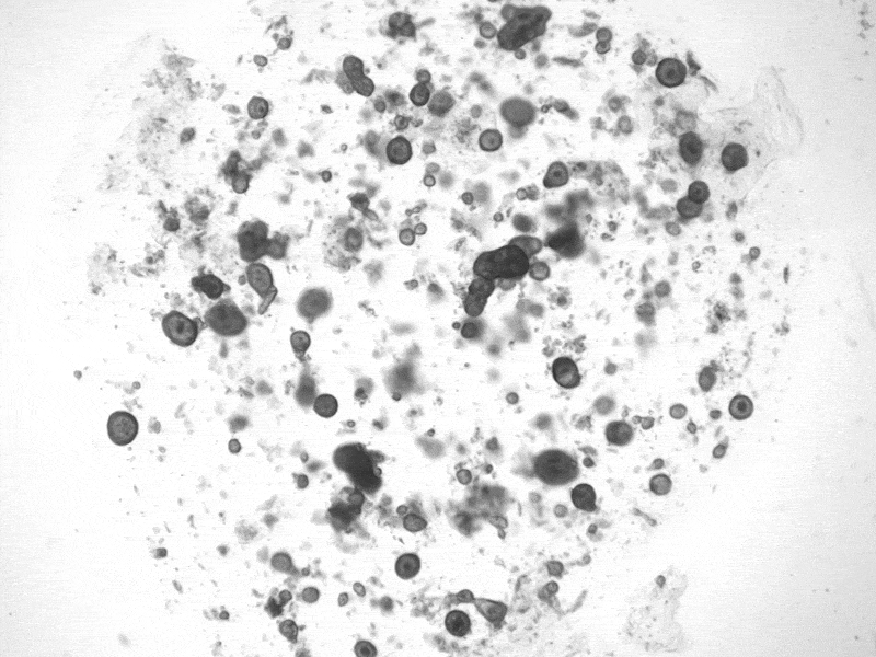 Human organoid swelling (i.e. crying) upon addition of adrenaline.