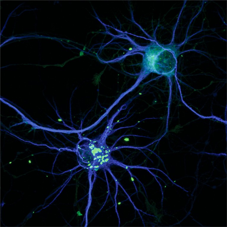 Cortical neurons or rats imaged by confocal microscopy