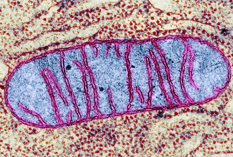 A coloured transmission electron micrograph of a Mitochondrion