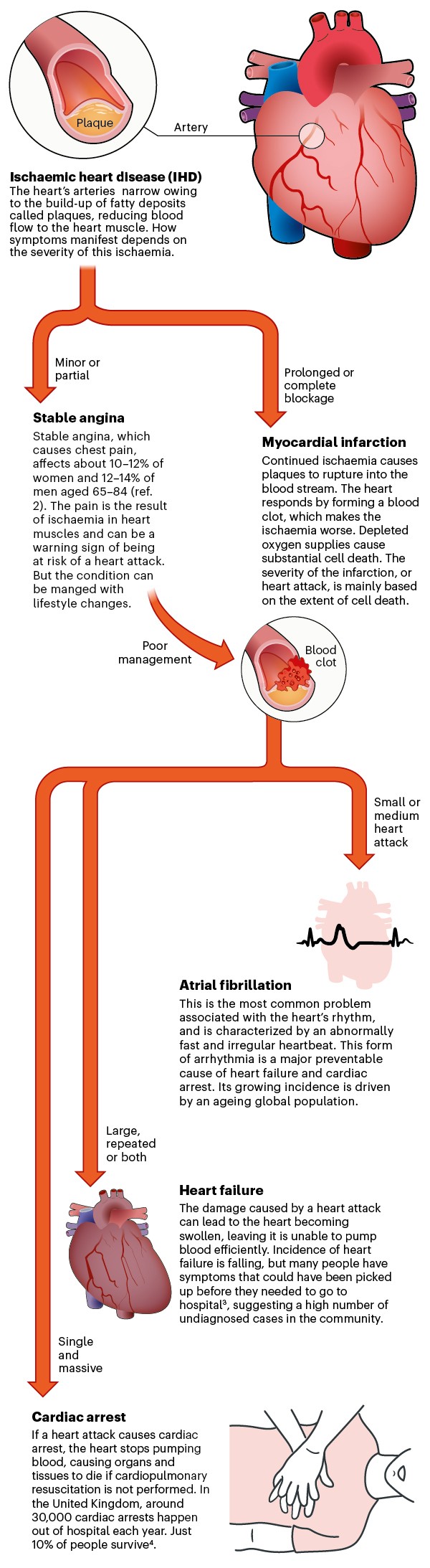 a-graphical-guide-to-ischaemic-heart-disease