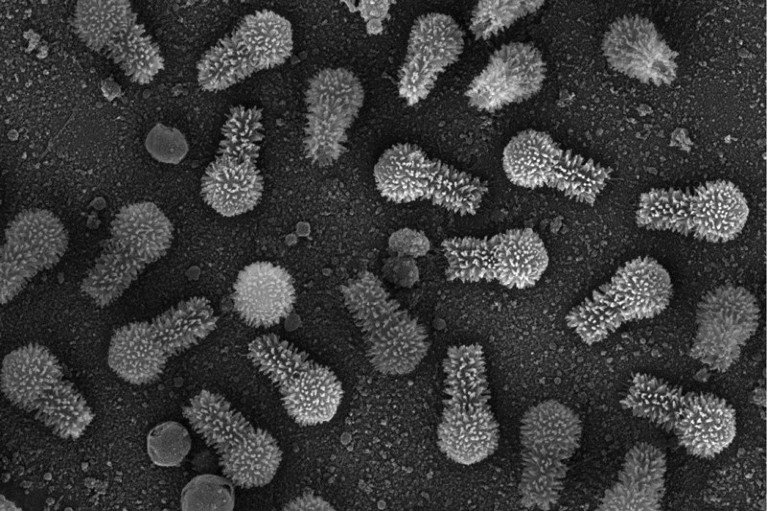 A black and white scanning electron micrograph of Tupanvirus particles have a round, tailed and fuzzy appearance